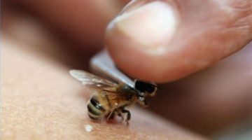 Таблетки от аллергии при укусе пчелы